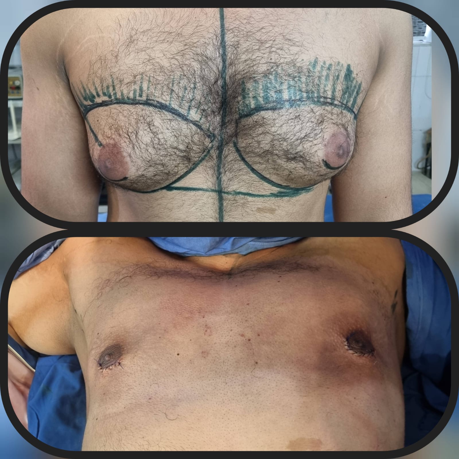 Before & After 37